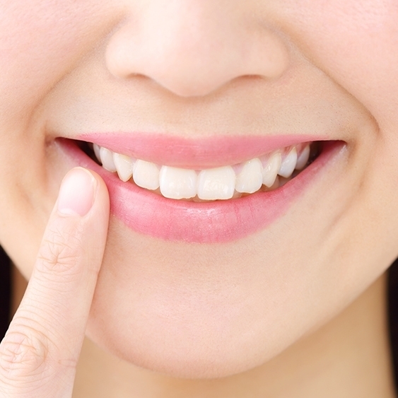 歯列矯正によって整った歯並びで笑う患者のイメージ写真