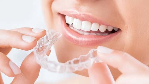 透明なマウスピース装置を着ける様子