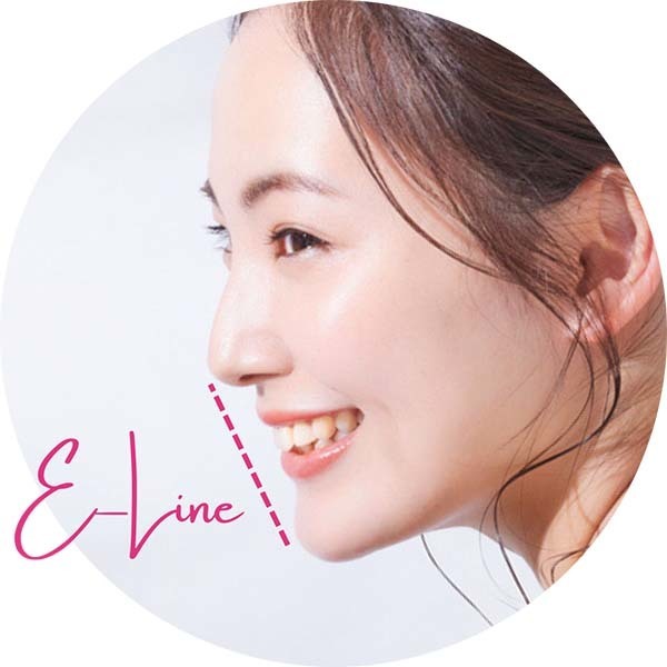 前歯だけを動かす矯正で失敗 - 新発田矯正歯科相談室