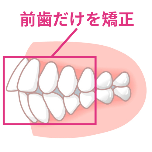 ＡＩの扱いで失敗のリスクが生じる