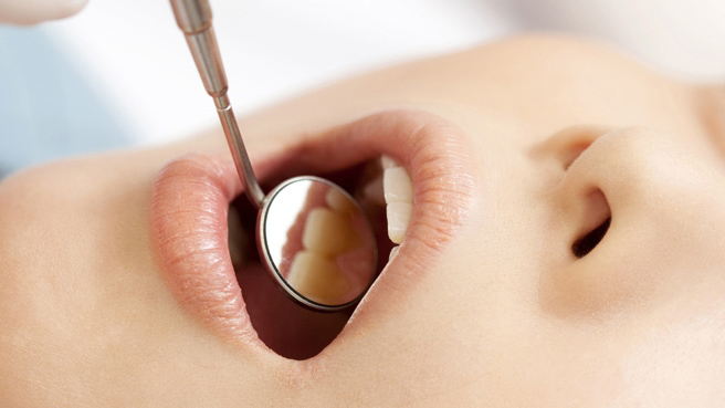 矯正治療と並行してクリーニングを受けている患者の口元